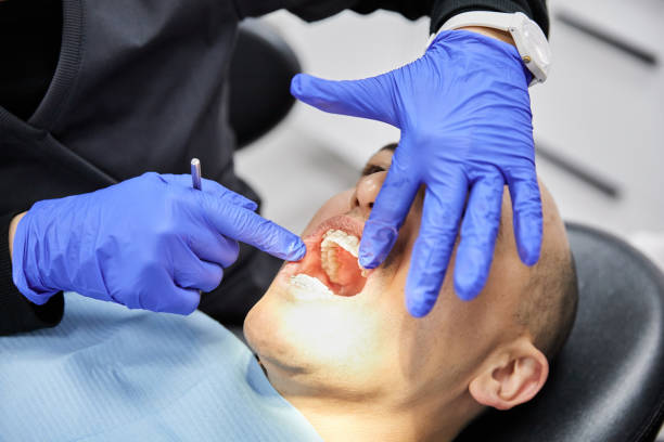 Best Emergency Denture Repair in Olney, MD